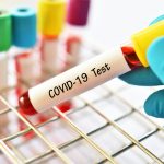I contagiati da coronavirus, potrebbero portare per sempre i segni della malattia