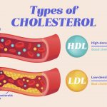 colesterolo alto: un rischio per la nostra salute